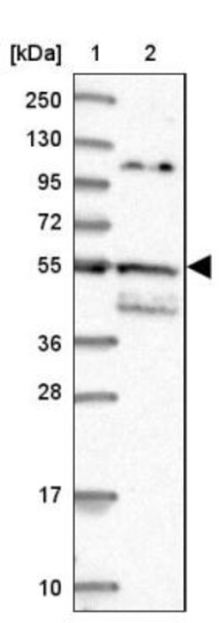 ALG3 Antibody, Novus Biologicals 25 &mu;L | Buy Online | Novus Biologicals | Fisher Scientific