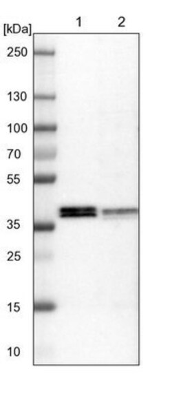 ALG5 Antibody, Novus Biologicals 0.1mL; Unlabeled:Antibodies, Polyclonal