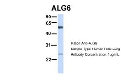 ALG6 Antibody, Novus Biologicals 100 &mu;L | Buy Online | Novus Biologicals | Fisher Scientific