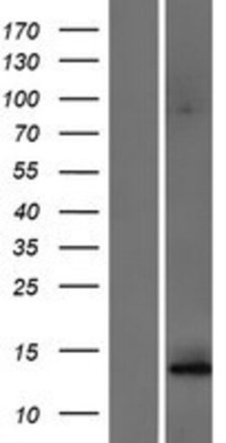 Novus Biologicals&trade;&nbsp;ALG6 Overexpression Lysate