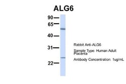 ALG6 Antibody, Novus Biologicals 100 &mu;L | Buy Online | Novus Biologicals | Fisher Scientific