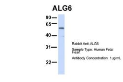 ALG6 Antibody, Novus Biologicals 100 &mu;L | Buy Online | Novus Biologicals | Fisher Scientific