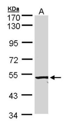 ALK-1 Antibody, Novus Biologicals 0.1mg; Unlabeled:Antibodies