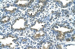 Alkaline Phosphatase/ALPP Antibody, Novus Biologicals 0.1mg; Unlabeled:Antibodies,