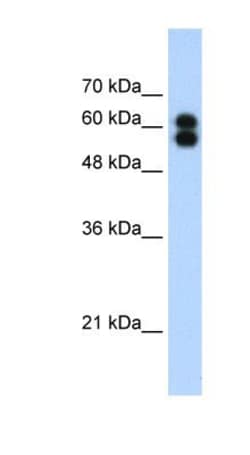 Alkaline Phosphatase/ALPP Antibody, Novus Biologicals 0.1mg; Unlabeled:Antibodies,