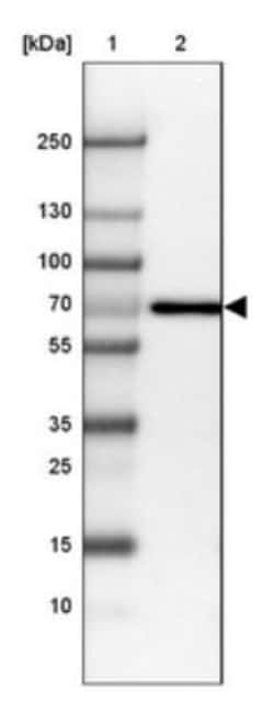 Alkaline Phosphatase/ALPP Antibody, Novus Biologicals:Antibodies:Primary