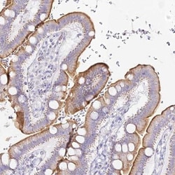 Alkaline Phosphatase, Intestinal Antibody, Novus Biologicals 0.1mL; Unlabeled:Antibodies,