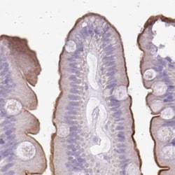 Alkaline Phosphatase, Intestinal Antibody, Novus Biologicals 25 &mu;L,