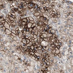 Alkaline Phosphatase, Tissue Non-Specific Antibody, Novus Biologicals 25