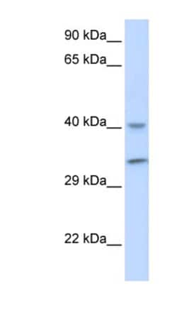 ALKBH3 Antibody, Novus Biologicals 100&mu;L; Unlabeled:Antibodies, Polyclonal