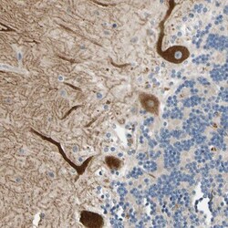ALKBH3 Antibody, Novus Biologicals 0.1mL; Unlabeled:Antibodies, Polyclonal