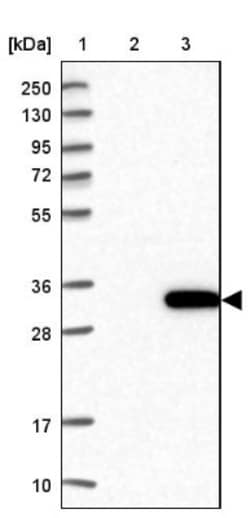 ALKBH7 Antibody, Novus Biologicals 25 &mu;L, Unlabeled:Antibodies, Polyclonal