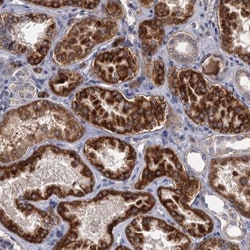ALKBH7 Antibody, Novus Biologicals 25 &mu;L, Unlabeled:Antibodies, Polyclonal