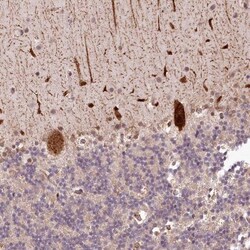 ALKBH8 Antibody, Novus Biologicals:Antibodies:Primary Antibodies