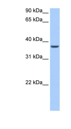 ALKBH8 Antibody, Novus Biologicals 100&mu;L; Unlabeled:Antibodies, Polyclonal