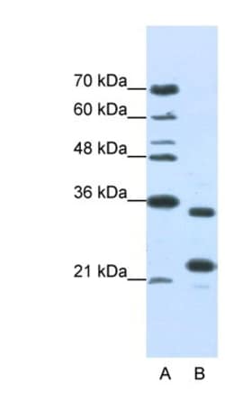 ALKBH8 Antibody, Novus Biologicals 100&mu;L; Unlabeled:Antibodies, Polyclonal