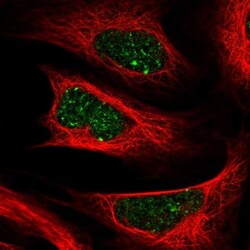 ALKBH8 Antibody, Novus Biologicals 25 &mu;L, Unlabeled:Antibodies, Polyclonal