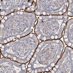 ALKBH8 Antibody, Novus Biologicals 25 &mu;L; Unlabeled:Antibodies, Polyclonal