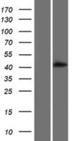 Novus Biologicals™ ALLC Overexpression Lysate