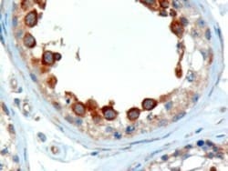 ALMS1 Antibody, Novus Biologicals 0.1mg; Unlabeled:Antibodies, Polyclonal