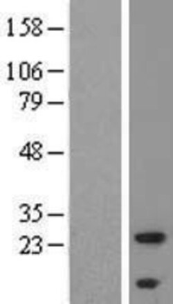 Novus Biologicals&trade;&nbsp;ALMS1P Overexpression Lysate