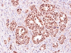 ALOXE3 Antibody, Novus Biologicals 0.1mg; Unlabeled:Antibodies, Polyclonal