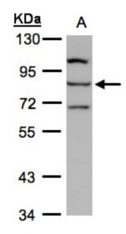 ALOXE3 Antibody, Novus Biologicals 0.1mg; Unlabeled:Antibodies, Polyclonal