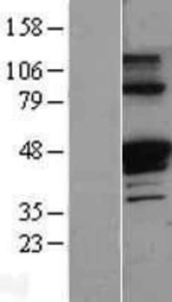 Novus Biologicals™ Serpin A1/alpha 1-Antitrypsin Overexpression Lysate
