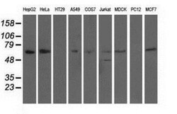alpha-Fetoprotein/AFP Antibody (OTI2A9), Novus Biologicals 0.1mL; Unlabeled:Antibodies,