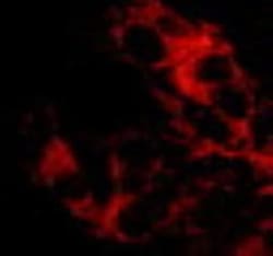 alpha 1 Mannosidase 1A Antibody, Novus Biologicals 0.1mL; Unlabeled:Antibodies,