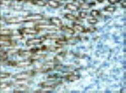 alpha 1 Mannosidase 1A Antibody, Novus Biologicals 0.1mL; Unlabeled:Antibodies,