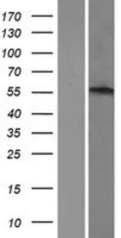 Novus Biologicals&trade;&nbsp;alpha-1B Adrenergic R/ADRA1B Overexpression Lysate