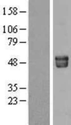 Novus Biologicals™ Fetuin A/AHSG Overexpression Lysate