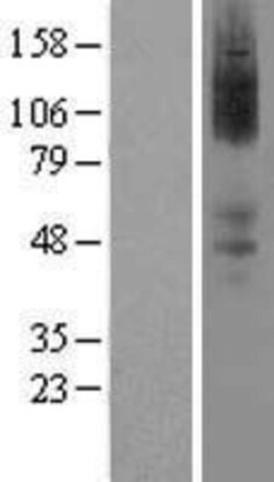 Novus Biologicals&trade;&nbsp;alpha-2A Adrenergic R/ADRA2A Overexpression Lysate
