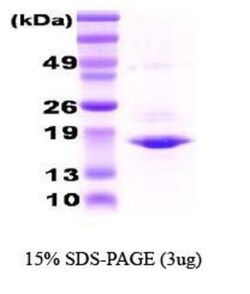Novus Biologicals&trade;&nbsp;Recombinant Human AlphaA Crystallin/CRYAA Protein