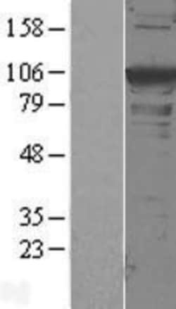 Novus Biologicals&trade;&nbsp;alpha-Actinin 1 Overexpression Lysate