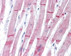 Alpha Actinin 2 Antibody, Novus Biologicals 0.1mL; Unlabeled:Antibodies,