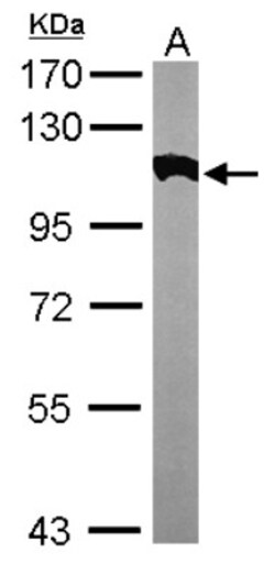 Alpha Actinin 2 Antibody, Novus Biologicals 0.1 mL | Buy Online | Novus Biologicals | Fisher Scientific