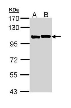 Alpha Actinin 2 Antibody, Novus Biologicals 0.1 mL | Buy Online | Novus Biologicals | Fisher Scientific