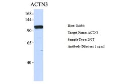 Alpha Actinin 3 Antibody, Novus Biologicals 0.05mg; Unlabeled:Antibodies,