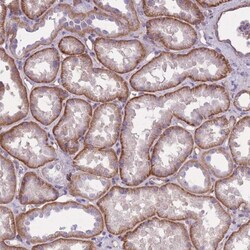 alpha Adducin Antibody, Novus Biologicals 25 &mu;L, Unlabeled:Antibodies,