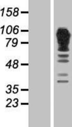 Novus Biologicals&trade;&nbsp;alpha Adducin Overexpression Lysate