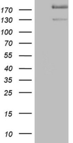 alpha Desmuslin Antibody (OTI7H6), Novus Biologicals 0.1mL; Unlabeled:Antibodies,