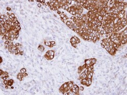 alpha Glucosidase 2 Antibody, Novus Biologicals 0.1mg; Unlabeled:Antibodies,