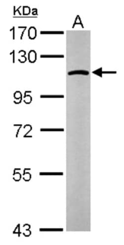 alpha Glucosidase 2 Antibody, Novus Biologicals 0.1mg; Unlabeled:Antibodies,