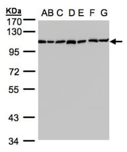 alpha Glucosidase 2 Antibody, Novus Biologicals 0.1mg; Unlabeled:Antibodies,