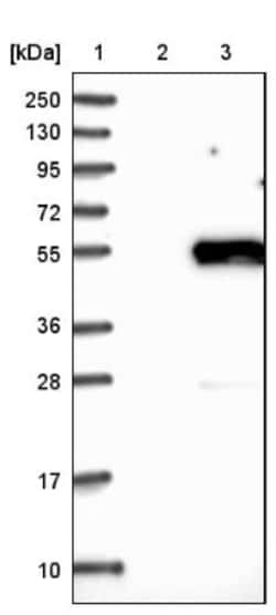 alpha-Sarcoglycan Antibody, Novus Biologicals 0.1mL; Unlabeled:Antibodies,