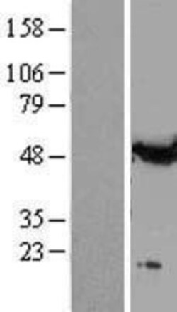 Novus Biologicals™ alpha Tubulin Overexpression Lysate