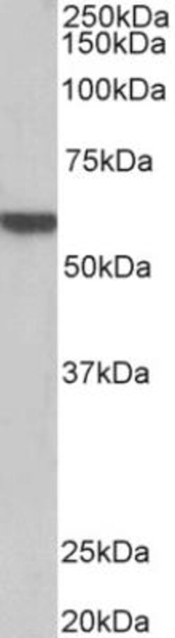 alpha-1B Adrenergic R/ADRA1B Antibody, Novus Biologicals 0.1mg; Unlabeled:Antibodies,