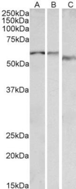alpha-1B Adrenergic R/ADRA1B Antibody, Novus Biologicals 0.1mg; Unlabeled:Antibodies,